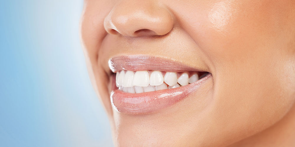 Fluoride Treatment Mississauga