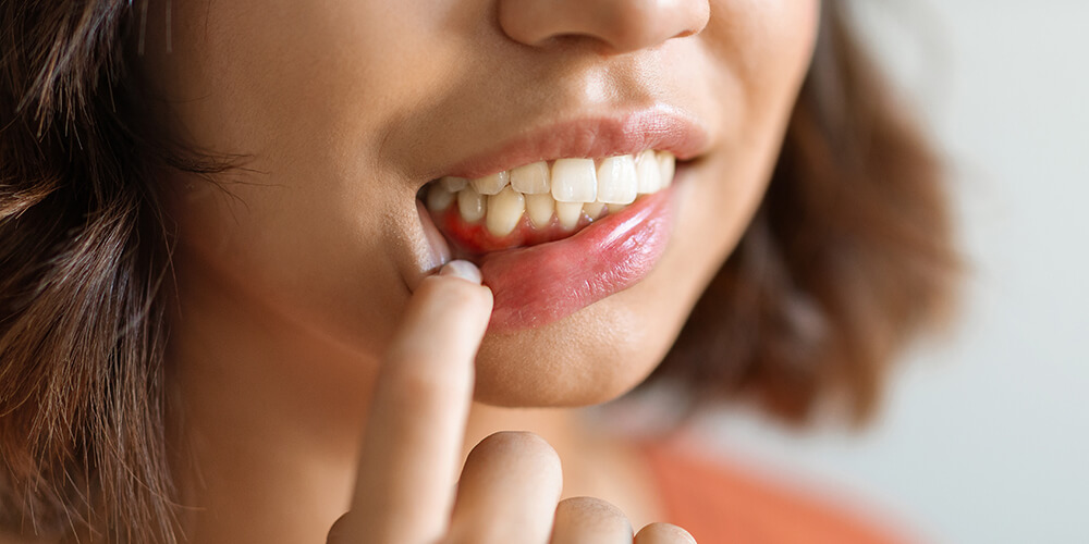 Periodontal Therapy Mississauga